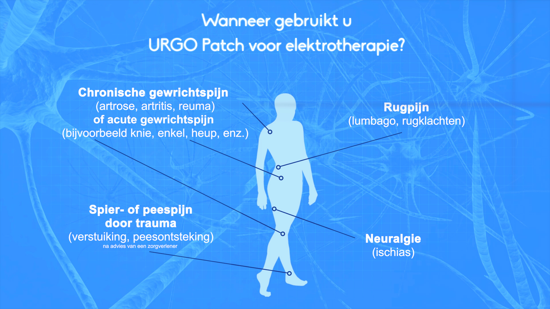 Wanneer gebruikt u URGO patch voor elektrotherapie?